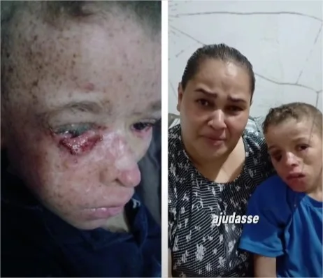 Ajude a Salvar a Vida do Vitor